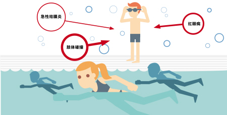 夏季當心紅眼病，網(wǎng)吧泳池成高發(fā)區(qū)