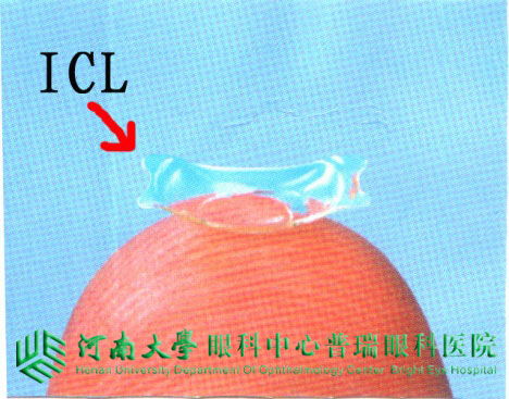 關(guān)注高度近視——ICL是個啥？