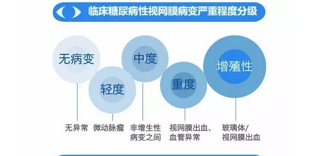 你造嗎？糖尿病晚期眼睛會致盲！