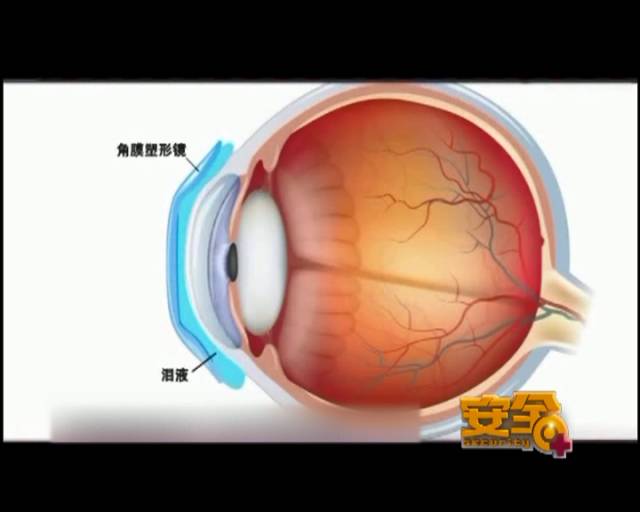 一夜之間真的能改變視力嗎？